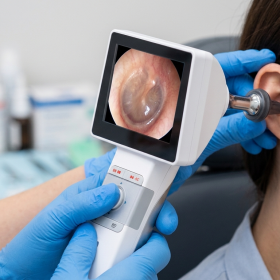 VIDEO OTOSCOPE